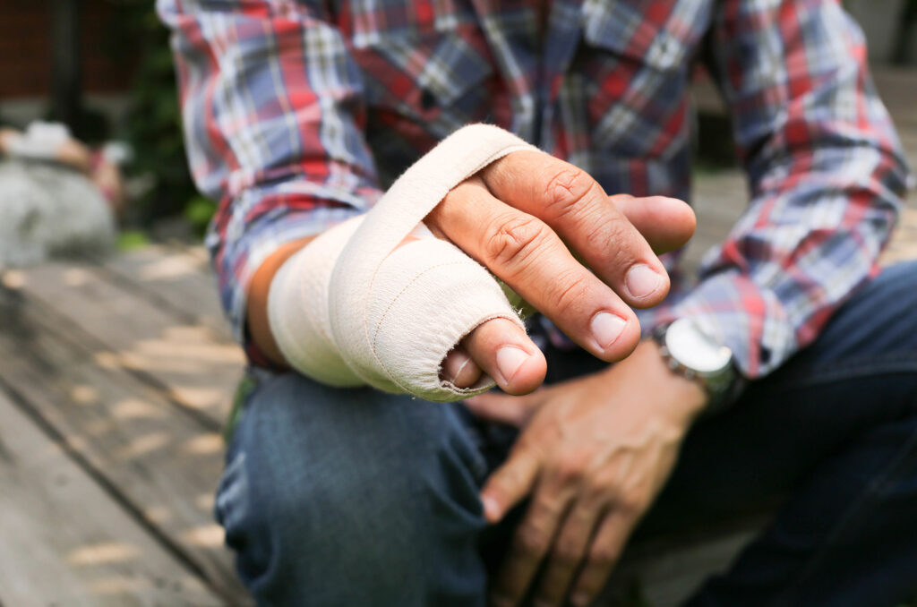 hand finger injury compensation claims solicitors Sheffield