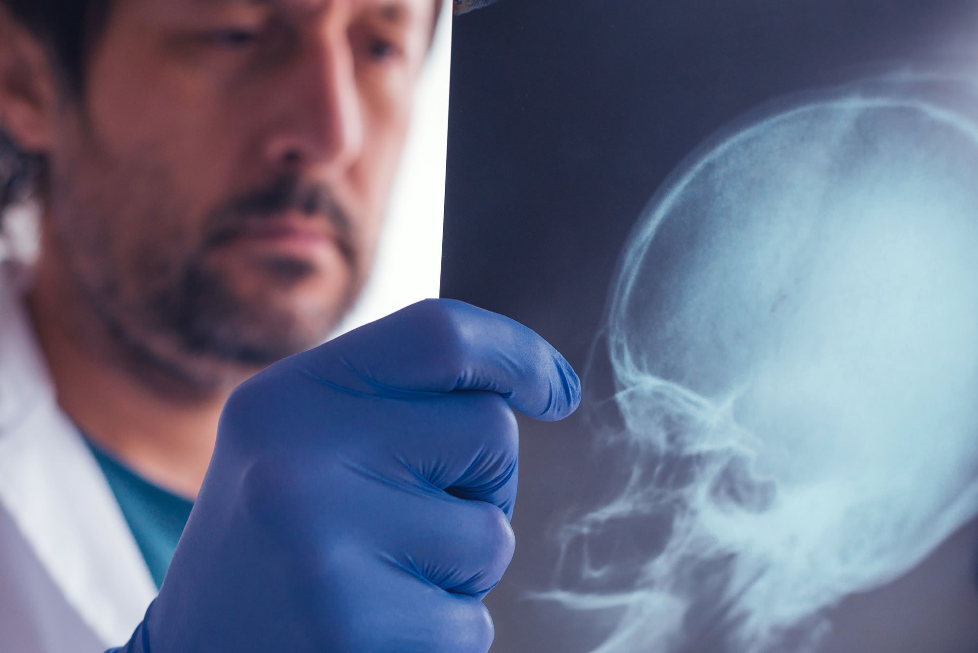examining x-ray of skull - brain/head injury claim compensation solicitors Sheffield
