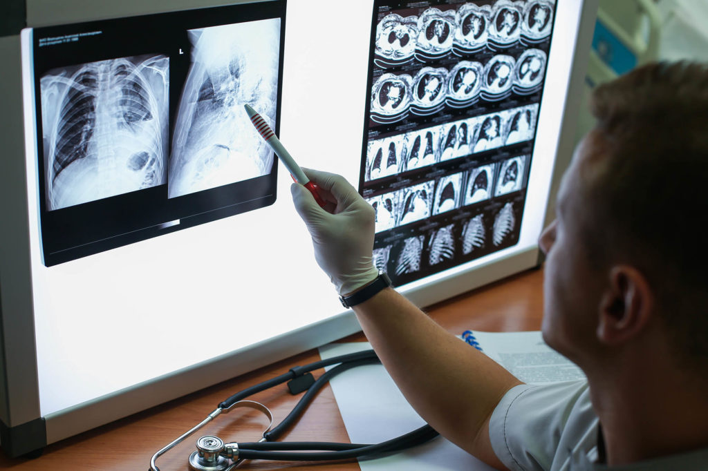 sheffield legionnaires disease lung disease compensation claims